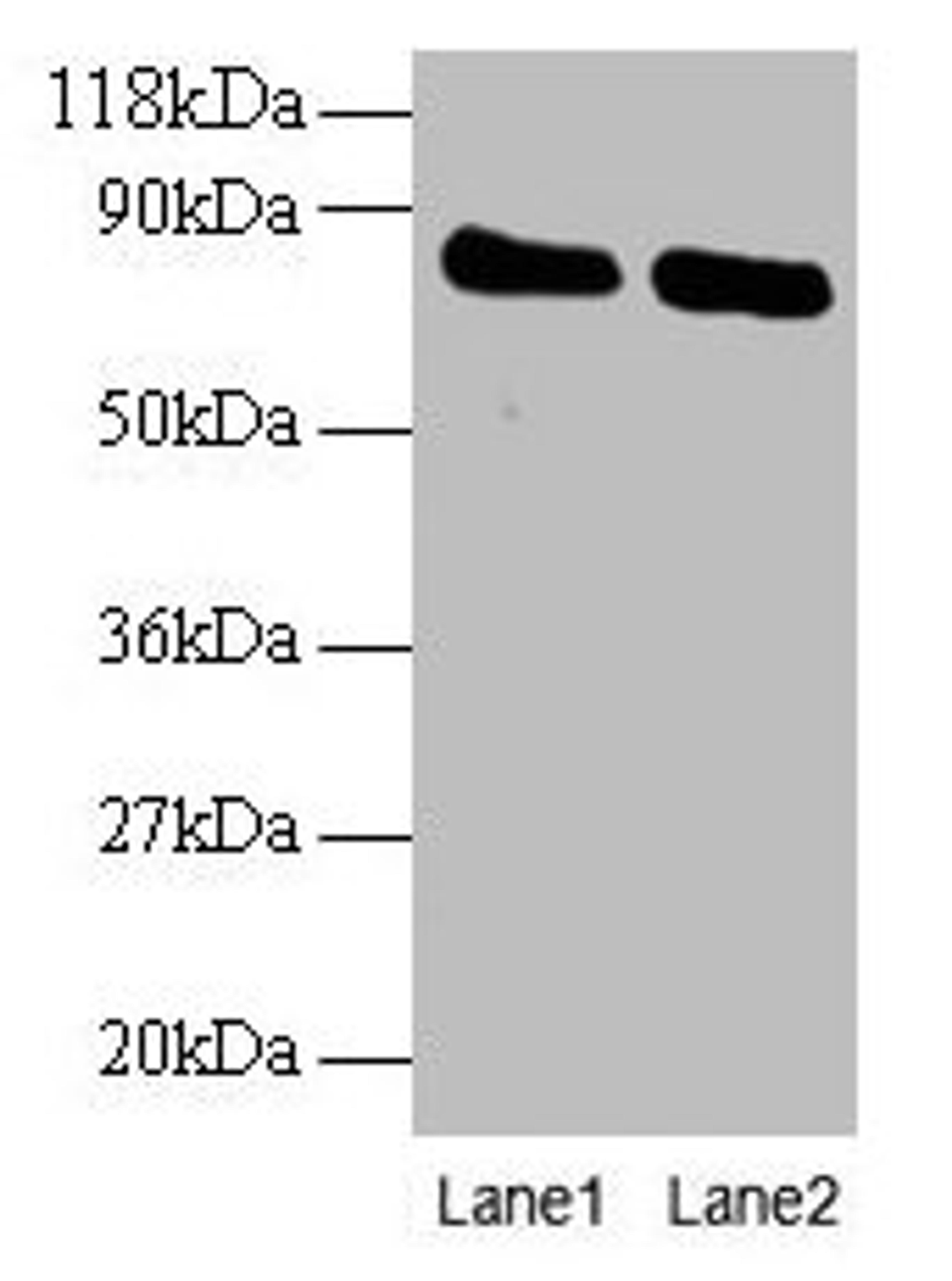 Western blot. All lanes: OTUB1 antibody at 2µg/ml. Lane 1: EC109 whole cell lysate. Lane 2: 293T whole cell lysate. Secondary. Goat polyclonal to rabbit IgG at 1/15000 dilution. Predicted band size: 32, 36 kDa. Observed band size: 80 kDa