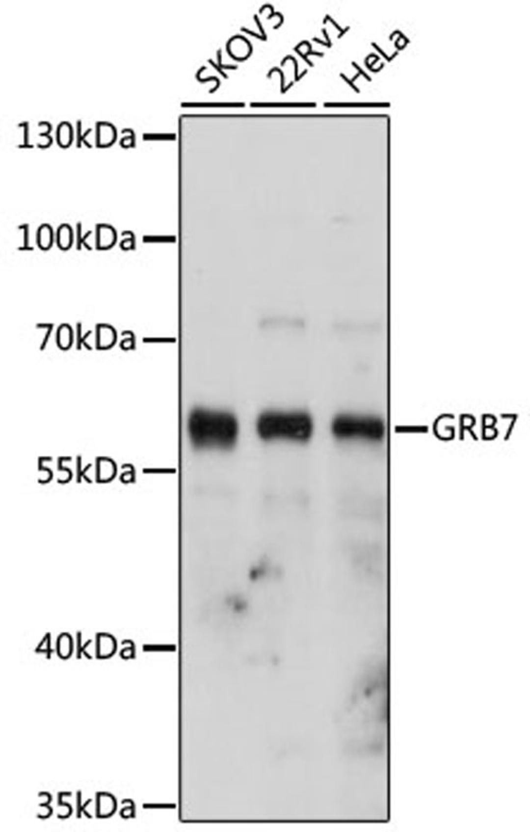 Western blot - GRB7 antibody (A5690)