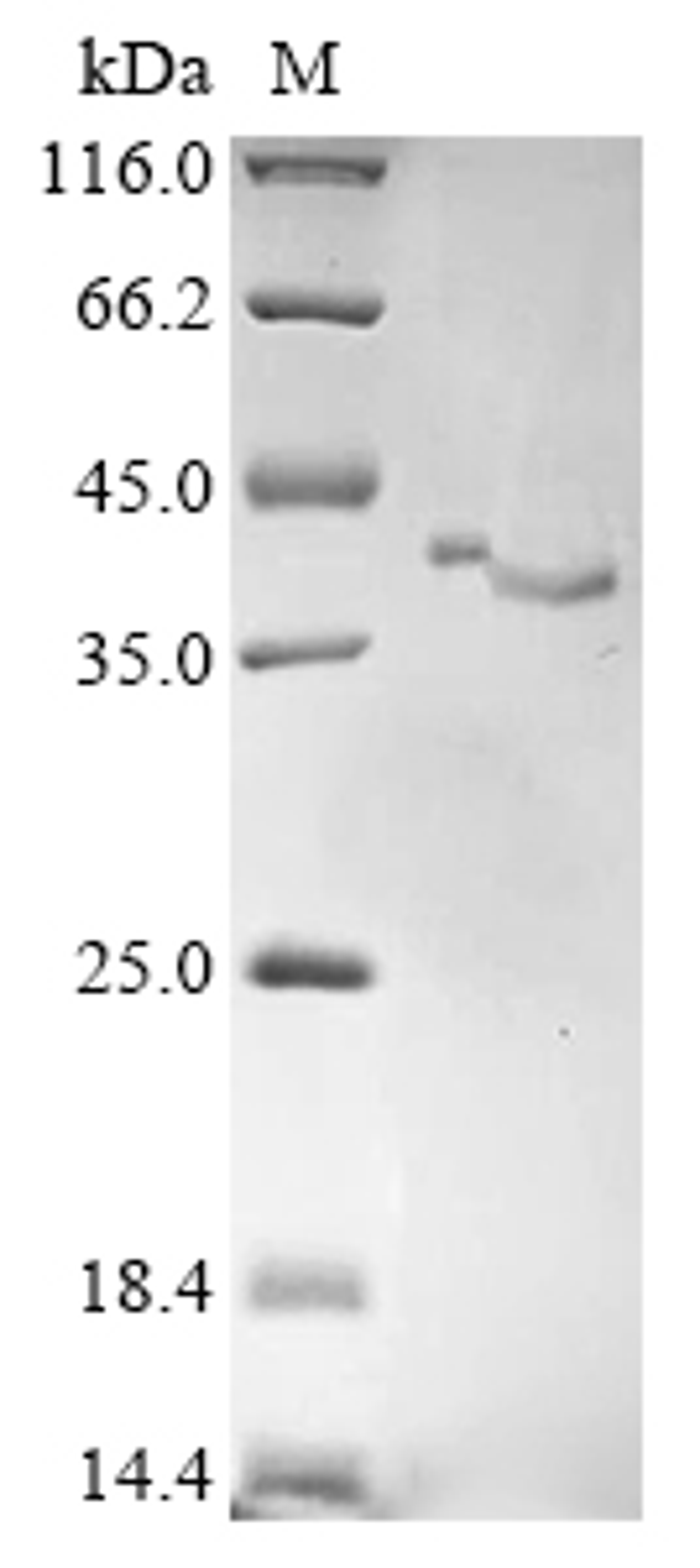 (Tris-Glycine gel) Discontinuous SDS-PAGE (reduced) with 5% enrichment gel and 15% separation gel.