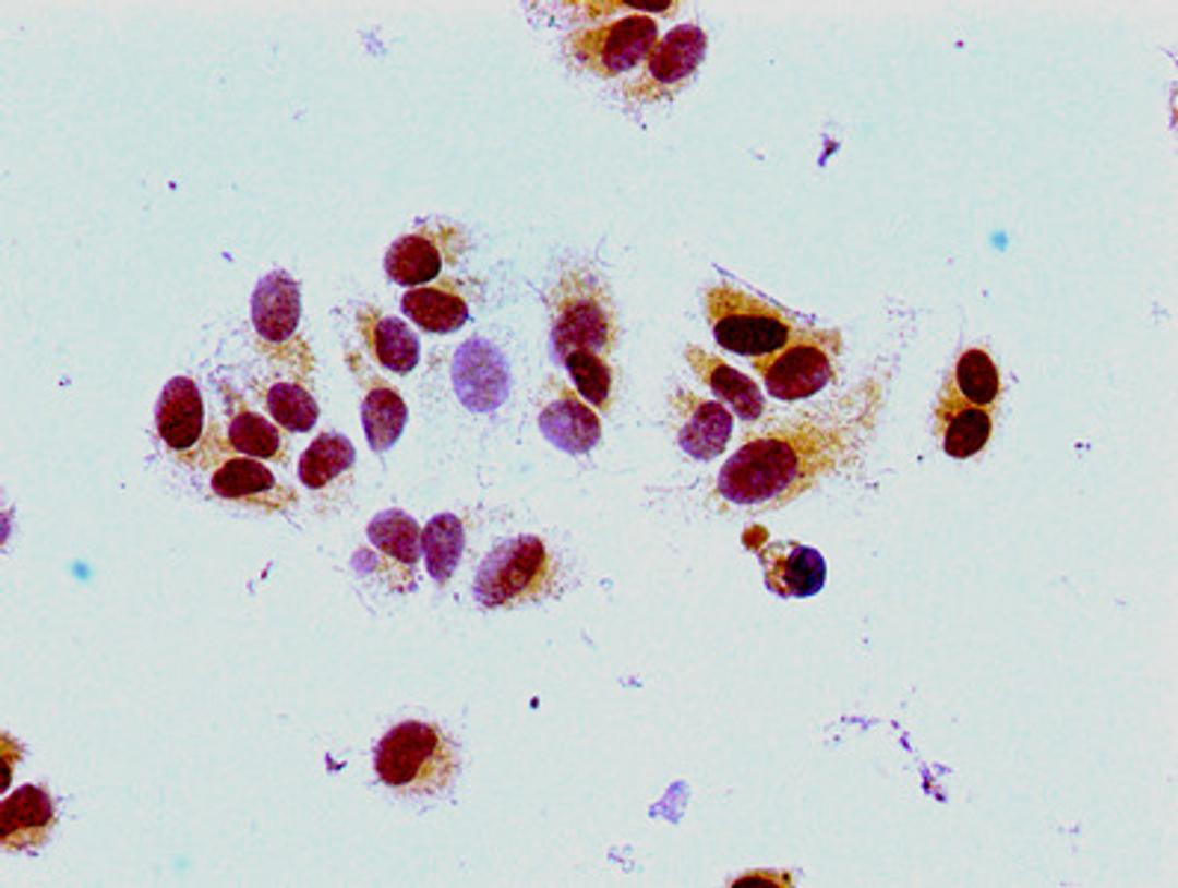Immunocytochemistry analysis of MCF-7 cells using CSB-PA010380PA16acHU at dilution of 1:100