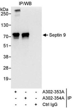 Detection of human Septin 9 by western blot of immunoprecipitates.