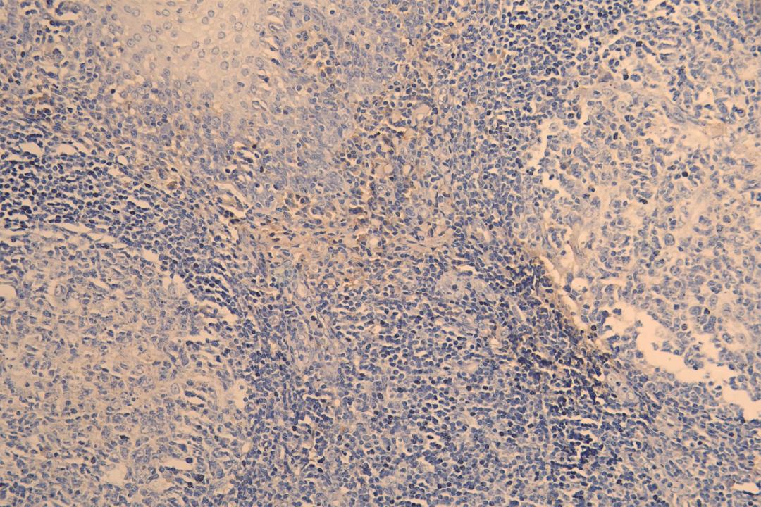 IHC image of CSB-RA023981MA1HU diluted at 1:200 and staining in paraffin-embedded human tonsil tissue performed on a Leica BondTM system. After dewaxing and hydration, antigen retrieval was mediated by high pressure in a citrate buffer (pH 6.0). Section was blocked with 10% normal goat serum 30min at RT. Then primary antibody (1% BSA) was incubated at 4°C overnight. The primary is detected by a Goat anti-human polymer IgG labeled by HRP and visualized using 0.05% DAB.