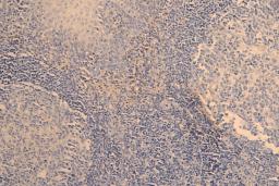 IHC image of CSB-RA023981MA1HU diluted at 1:200 and staining in paraffin-embedded human tonsil tissue performed on a Leica BondTM system. After dewaxing and hydration, antigen retrieval was mediated by high pressure in a citrate buffer (pH 6.0). Section was blocked with 10% normal goat serum 30min at RT. Then primary antibody (1% BSA) was incubated at 4°C overnight. The primary is detected by a Goat anti-human polymer IgG labeled by HRP and visualized using 0.05% DAB.