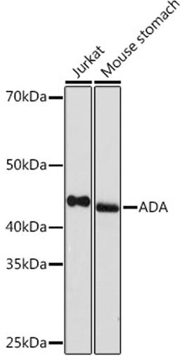 Western blot - ADA Rabbit mAb (A5151)