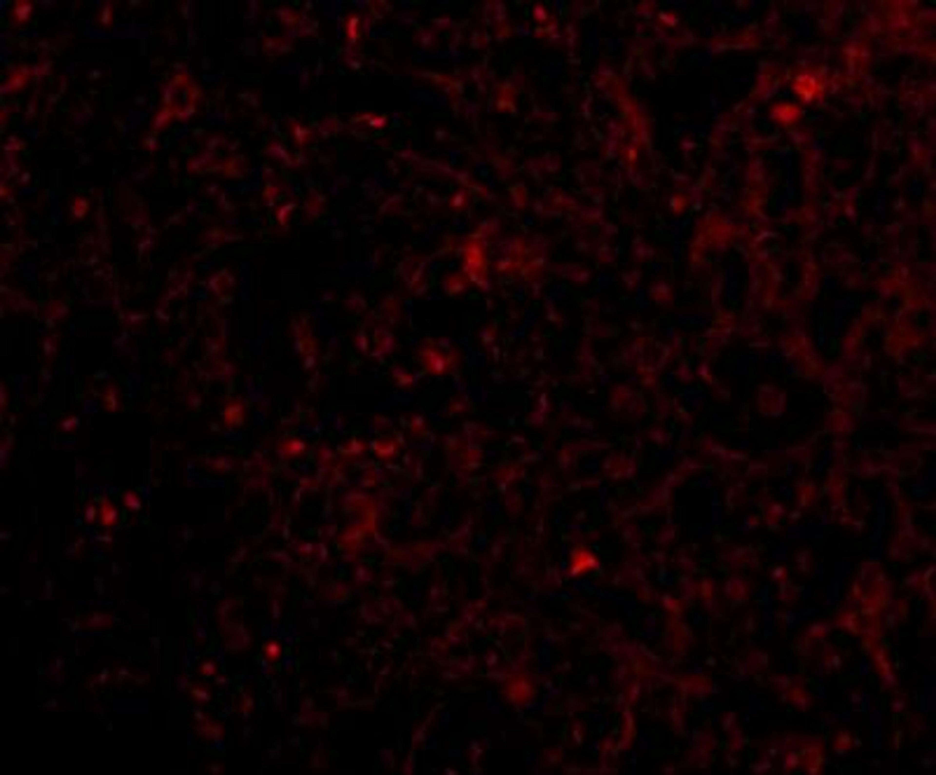 Immunocytochemistry/Immunofluorescence: STEAP1 Antibody [NBP1-76822] - Immunofluorescence of STEAP1 in human spleen tissue with STEAP1 antibody at 20 ug/mL.