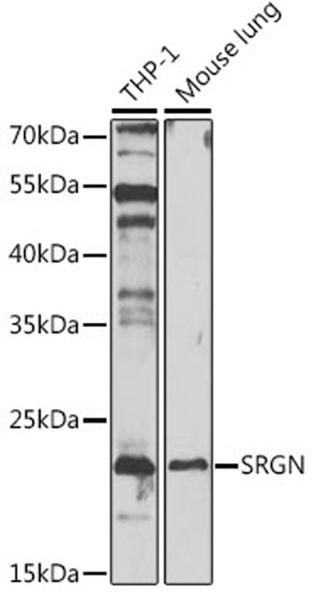 Western blot - SRGN antibody (A13340)