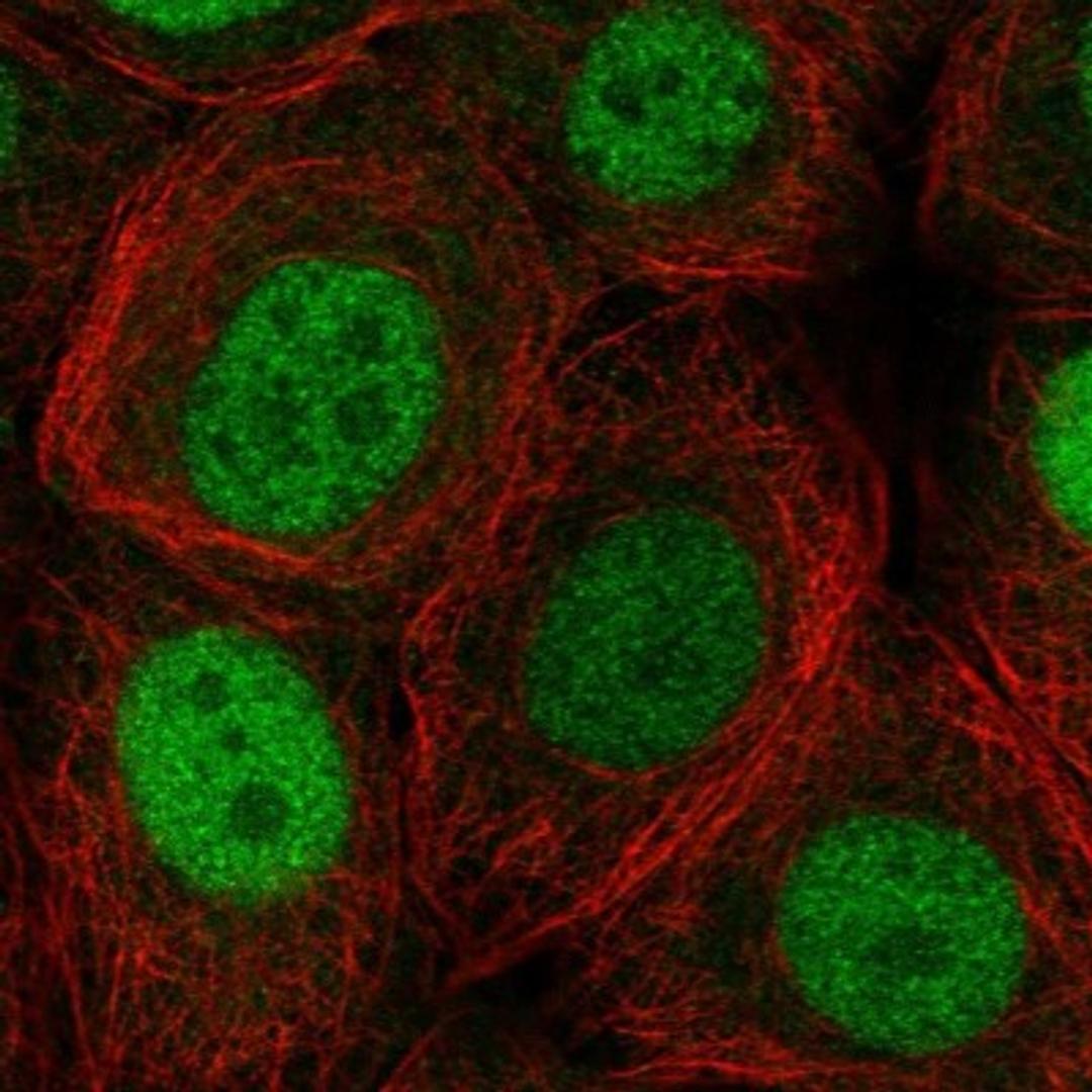 Immunofluorescence: COPR5 Antibody [NBP2-30884] - Immunofluorescent staining of human cell line MCF-7 shows positivity in nucleus but not nucleoli.