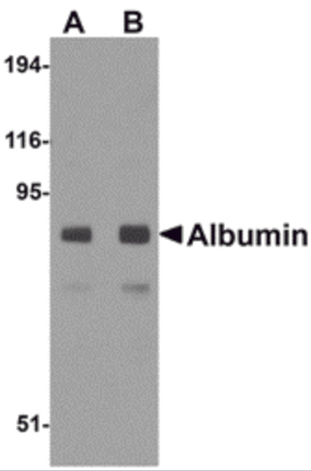 Western blot analysis of Albumin in mouse liver tissue lysate with Albumin antibody at (A) 1 and (B) 2 μg/mL.
