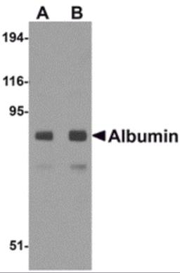 Western blot analysis of Albumin in mouse liver tissue lysate with Albumin antibody at (A) 1 and (B) 2 μg/mL.