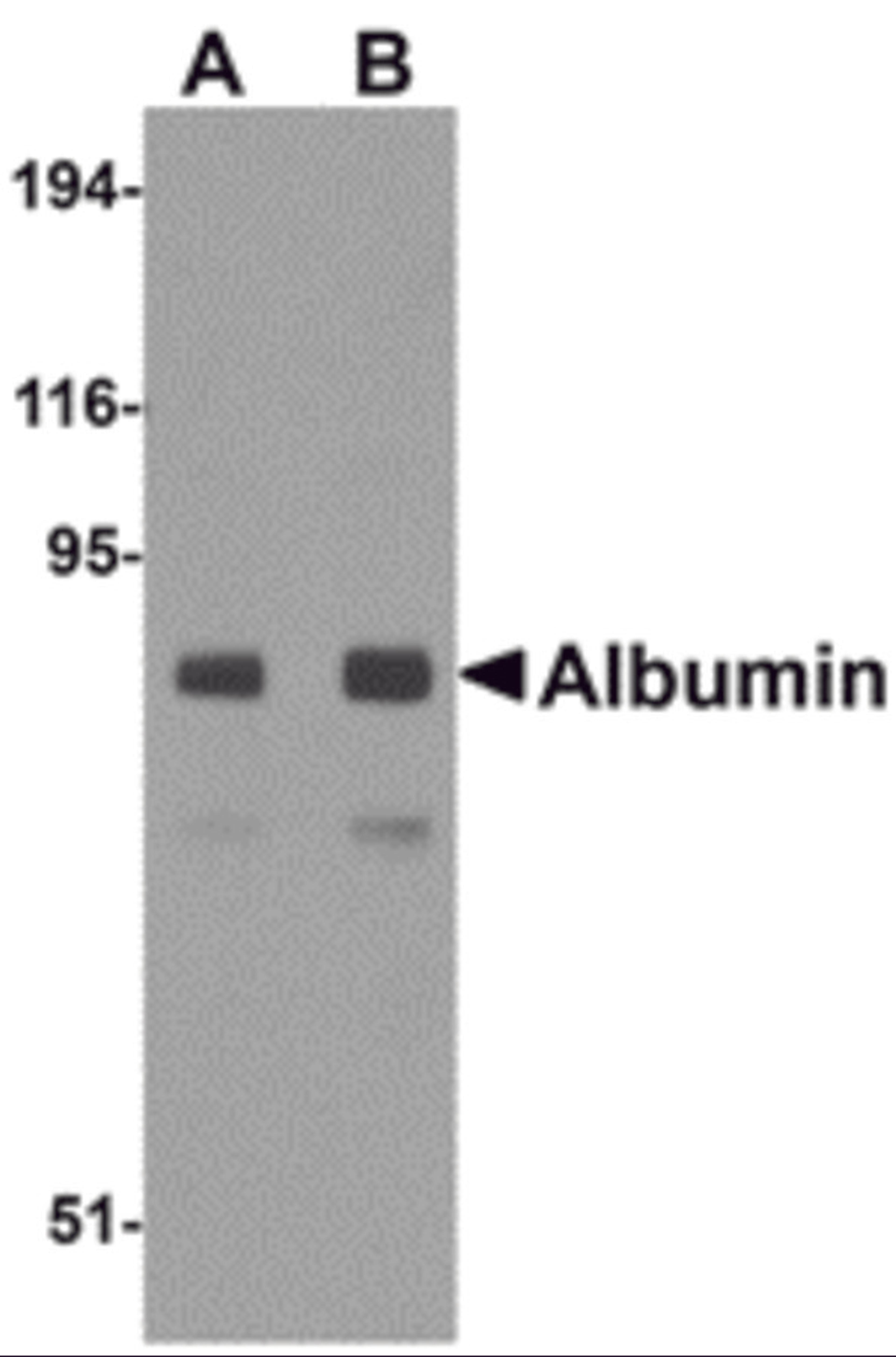 Western blot analysis of Albumin in mouse liver tissue lysate with Albumin antibody at (A) 1 and (B) 2 μg/mL.