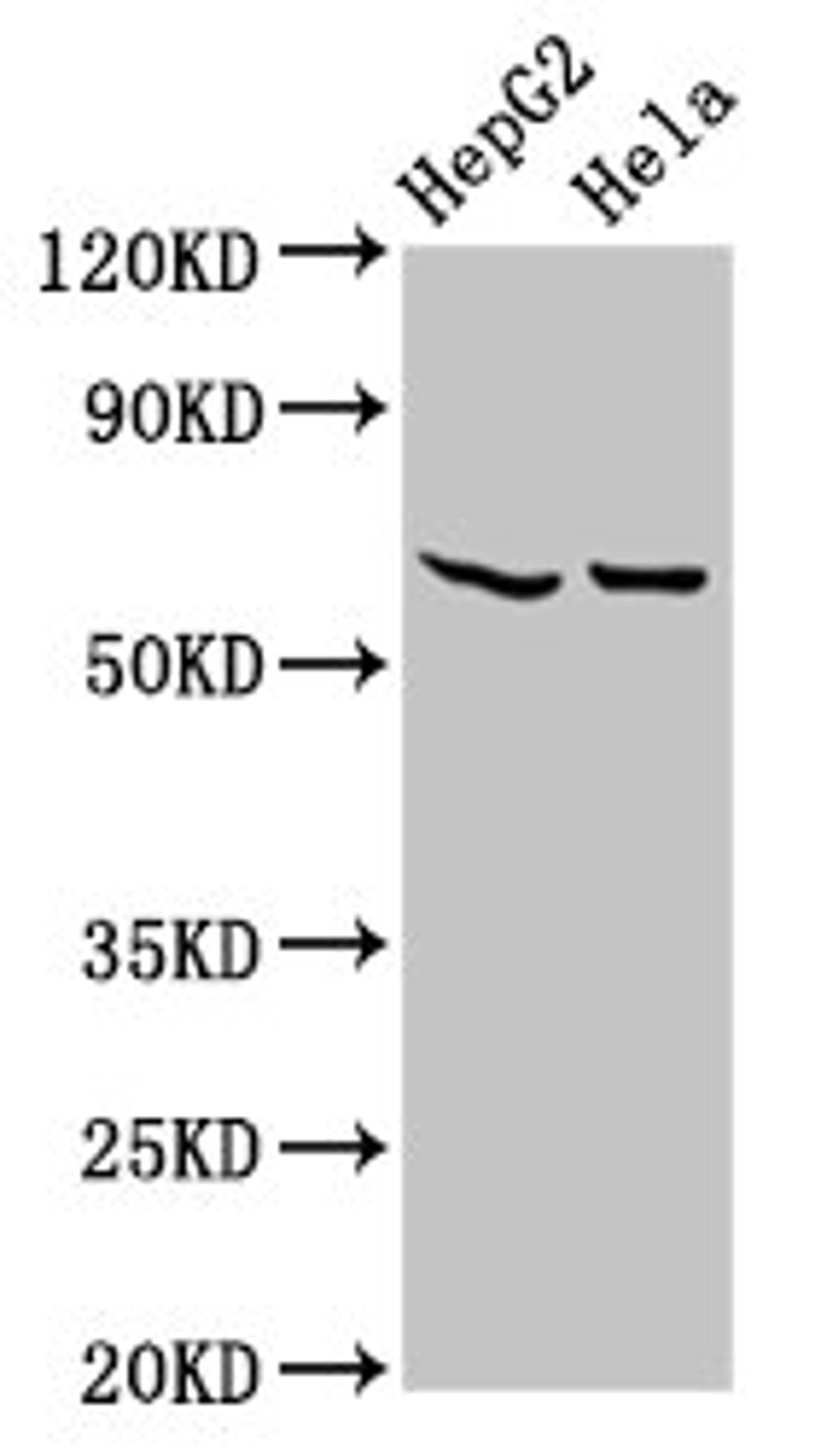 Western Blot. Positive WB detected in: HepG2 whole cell lysate, Hela whole cell lysate. All lanes: MT-ND5 antibody at 4.6µg/ml. Secondary. Goat polyclonal to rabbit IgG at 1/50000 dilution. Predicted band size: 68 kDa. Observed band size: 68 kDa