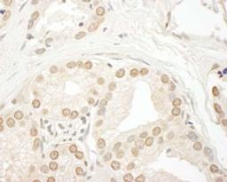 Detection of human SMG9 by immunohistochemistry.