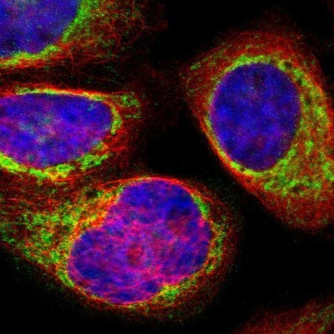 Immunocytochemistry/Immunofluorescence: SYNJ2BP/ARIP2 Antibody [NBP1-88985] - Staining of human cell line A-431 shows positivity in mitochondria.