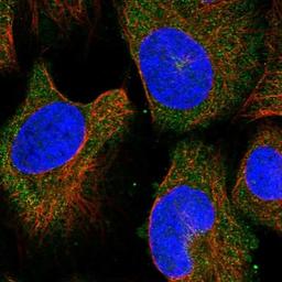 Immunocytochemistry/Immunofluorescence: KIAA1468 Antibody [NBP1-93851] - Staining of human cell line U-2 OS shows positivity in cytoplasm.