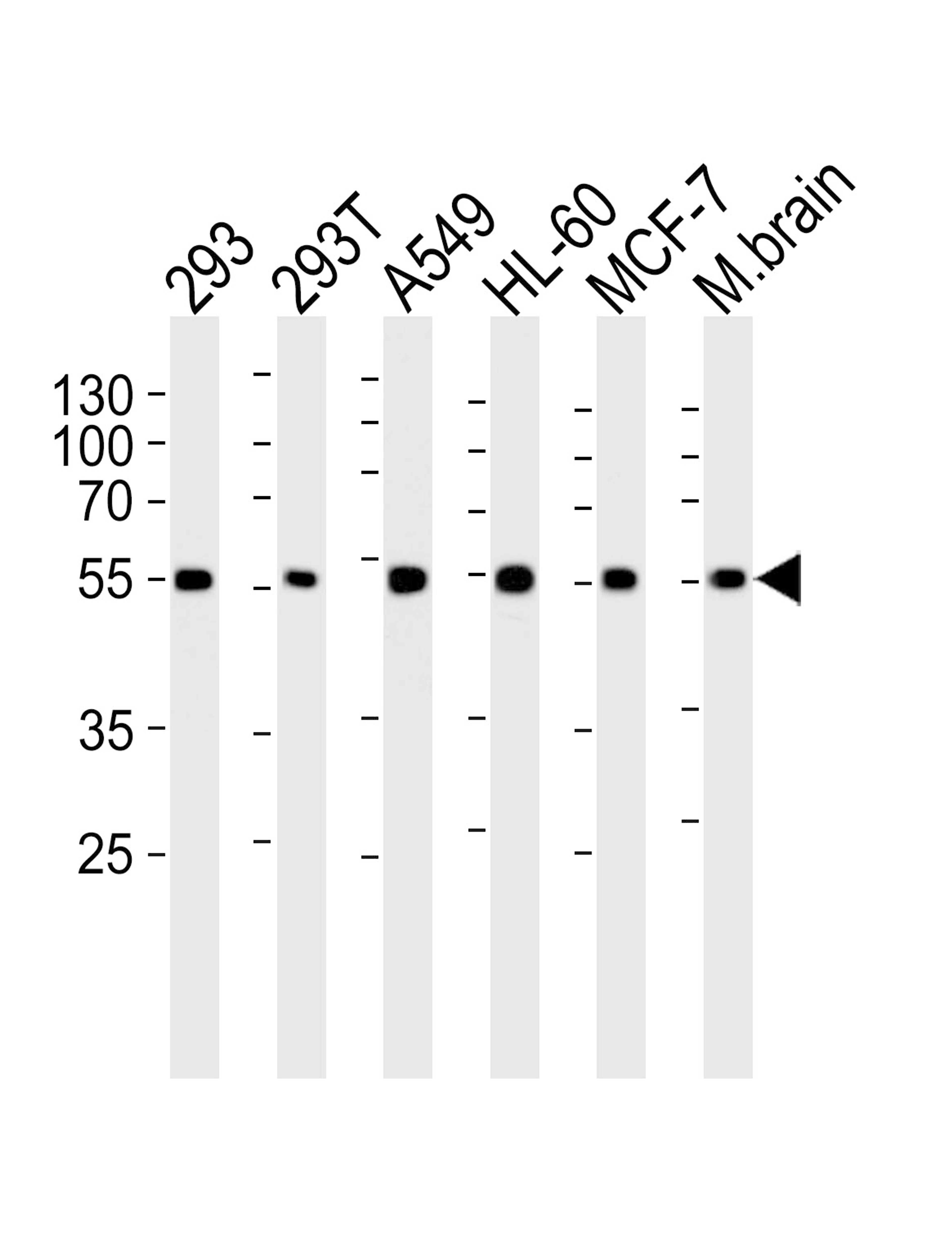 Western blot analysis of lysates from 293, 293T, A549, HL-60, MCF-7 cell line and mouse brain tissue lysate (from left to right), using DKK3 Antibody (A30) at 1:1000 at each lane.