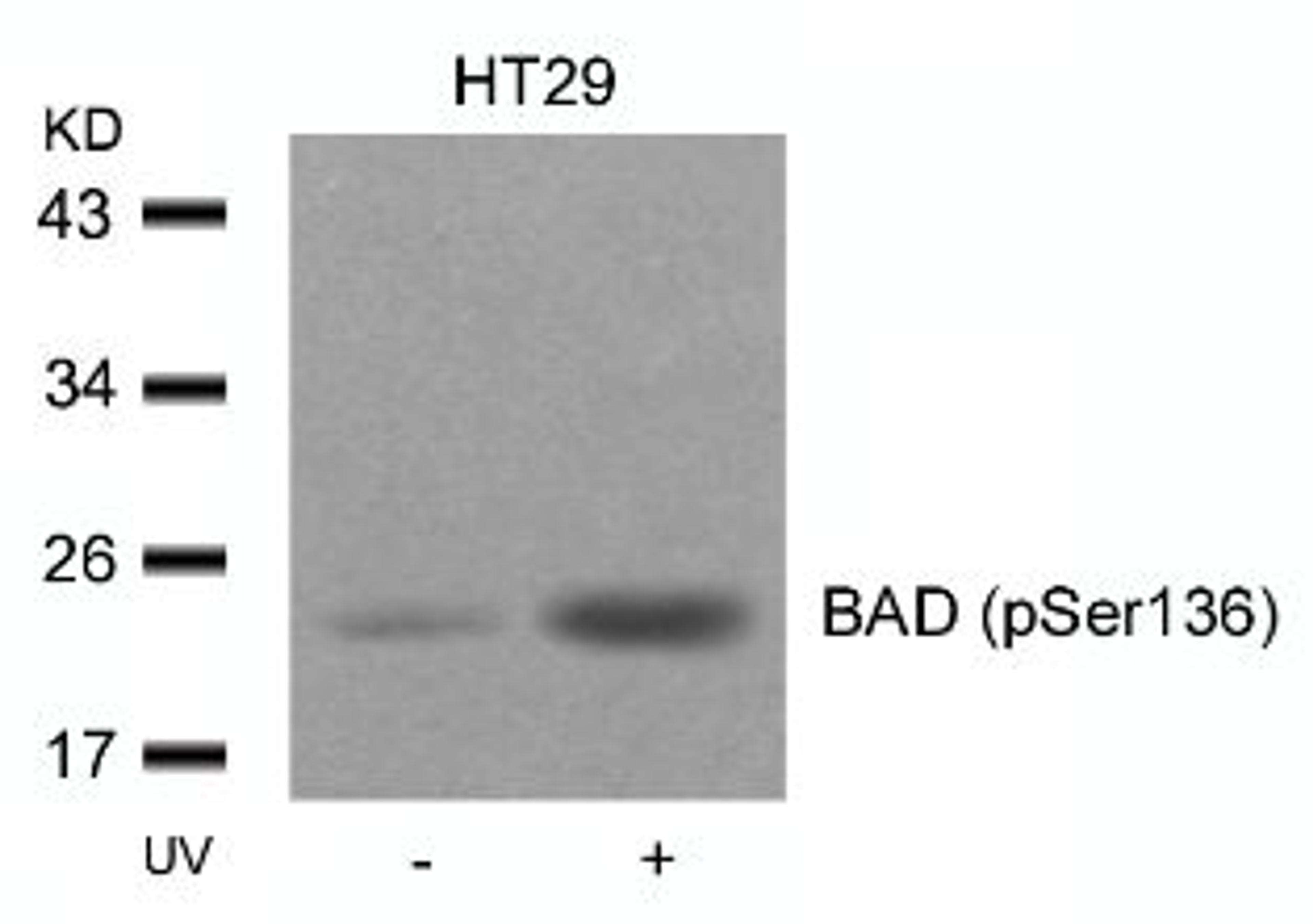 Western blot analysis of lysed extracts from HT29 cells untreated or treated with UV using BAD (Phospho-Ser136).