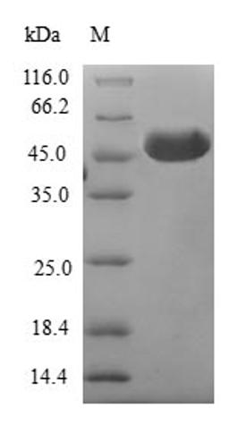 (Tris-Glycine gel) Discontinuous SDS-PAGE (reduced) with 5% enrichment gel and 15% separation gel.
