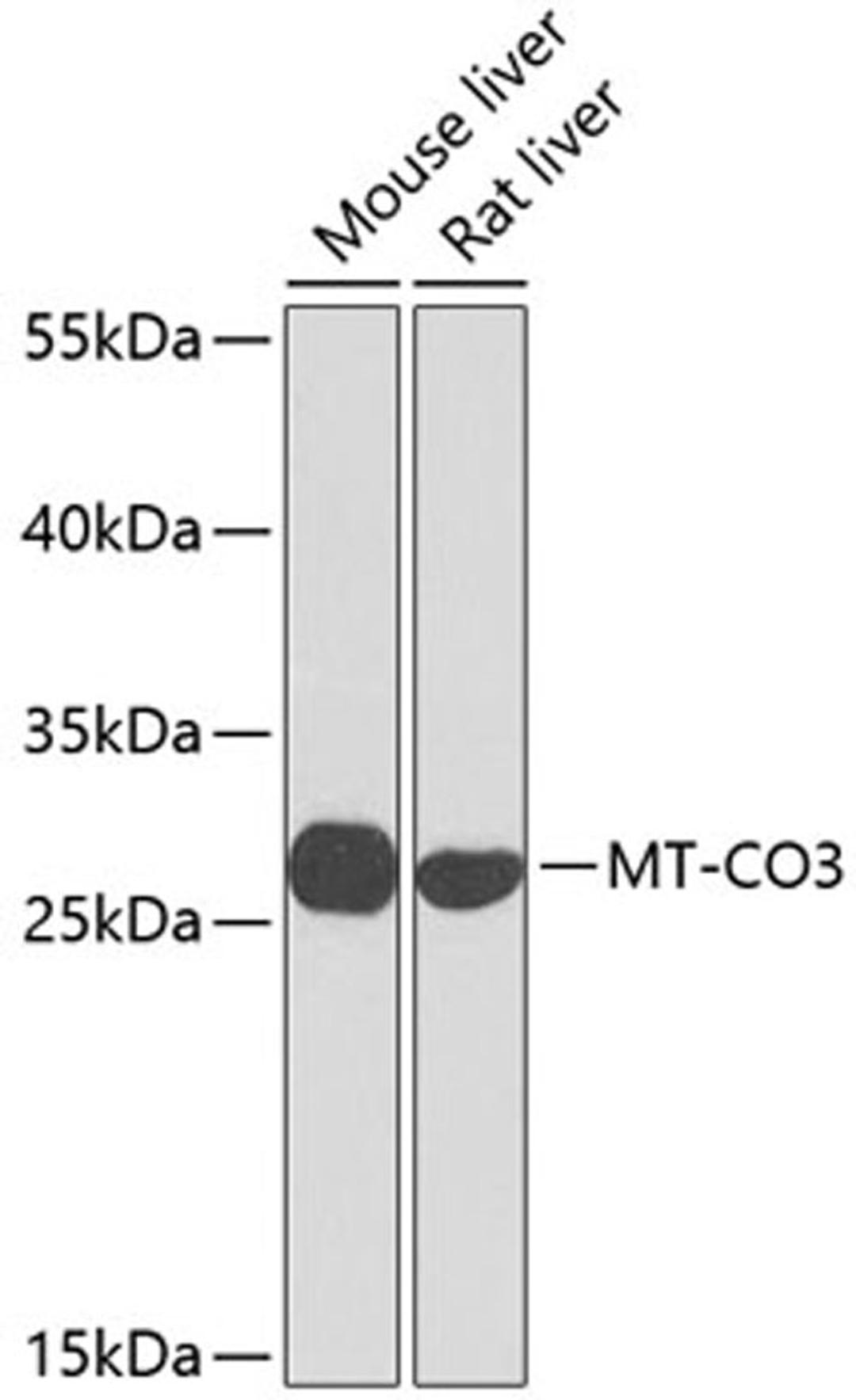 Western blot - MT-CO3 antibody (A9939)