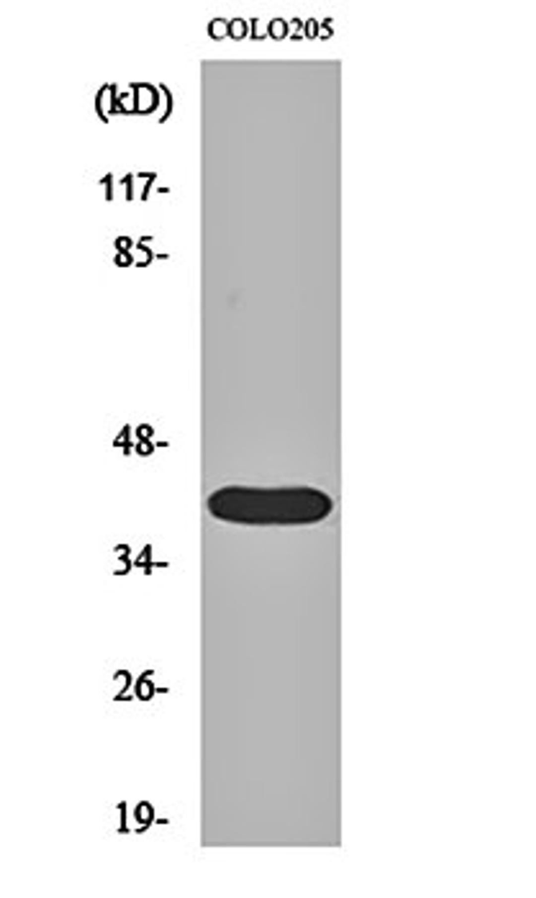 Western blot analysis of COLO205 cell lysates using 3pK antibody