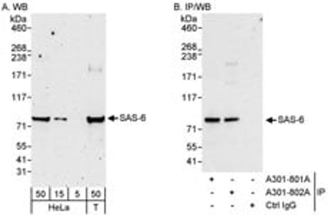 Detection of human SAS-6 by western blot and immunoprecipitation.