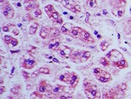 Immunohistochemistry-Paraffin: BST2 Antibody [NBP2-27154] - Analysis of BST2 in human liver tissue using BST2 antibody at 5 ug/ml.