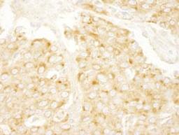 Detection of human PRKAR2A/PKA-RIIalpha by immunohistochemistry.