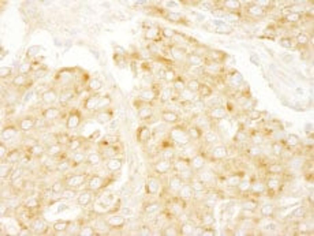 Detection of human PRKAR2A/PKA-RIIalpha by immunohistochemistry.