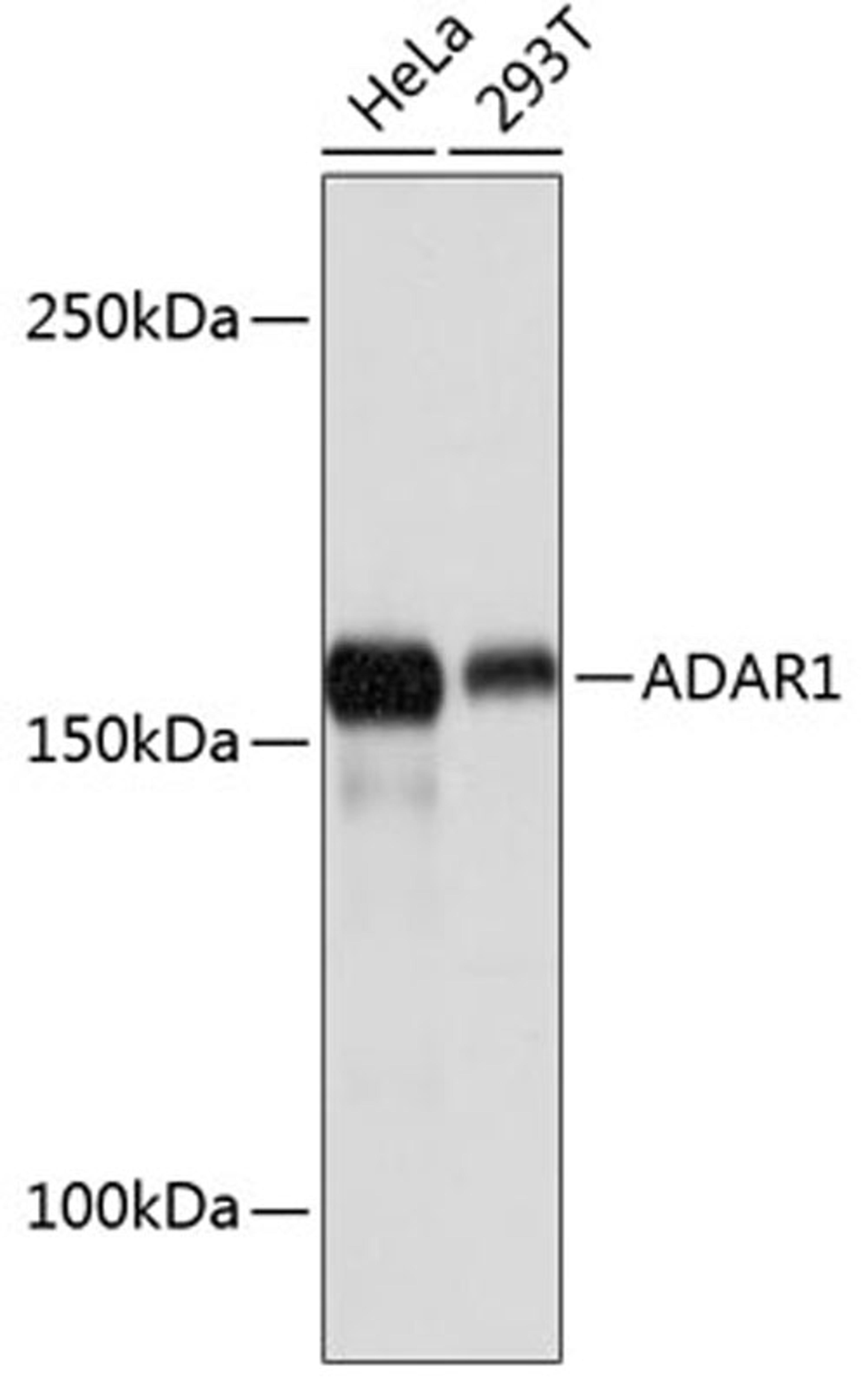 Western blot - ADAR1 Rabbit mAb (A11466)