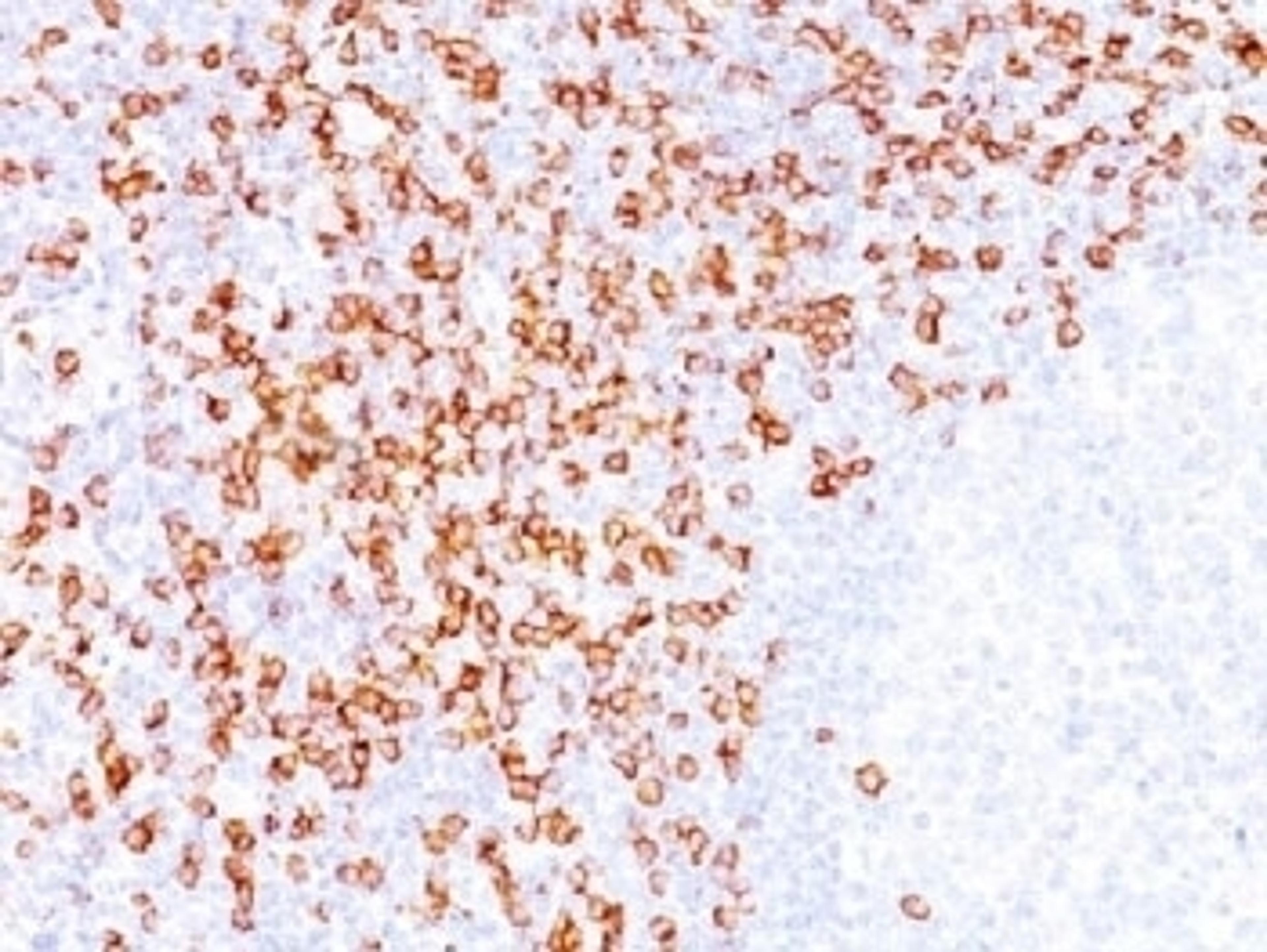 IHC testing of FFPE tonsil tissue with CD8 antibody (clone C8/144B)