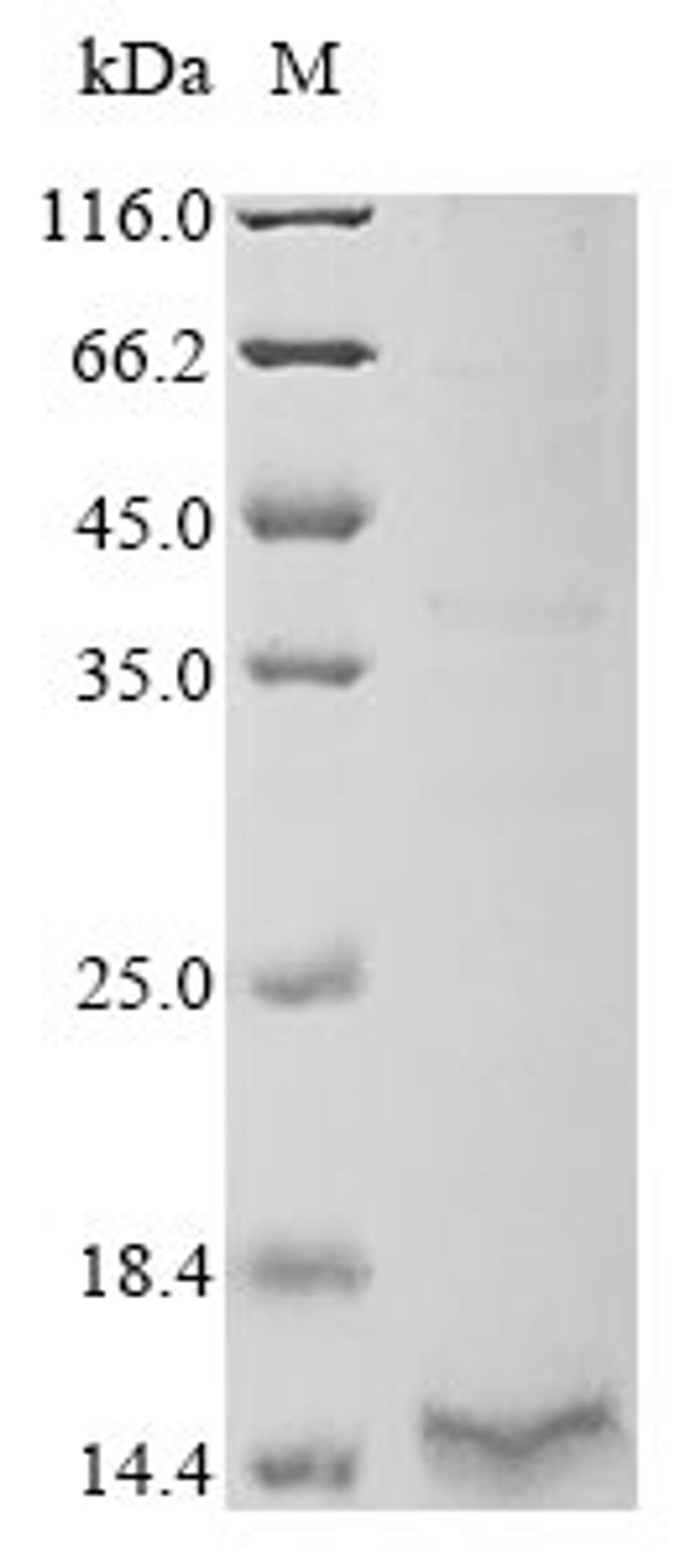 (Tris-Glycine gel) Discontinuous SDS-PAGE (reduced) with 5% enrichment gel and 15% separation gel.