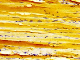 IHC image of CSB-PA006968LA01HU diluted at 1:500 and staining in paraffin-embedded human skeletal muscle tissue performed on a Leica BondTM system. After dewaxing and hydration, antigen retrieval was mediated by high pressure in a citrate buffer (pH 6.0). Section was blocked with 10% normal goat serum 30min at RT. Then primary antibody (1% BSA) was incubated at 4&deg;C overnight. The primary is detected by a biotinylated secondary antibody and visualized using an HRP conjugated SP system.