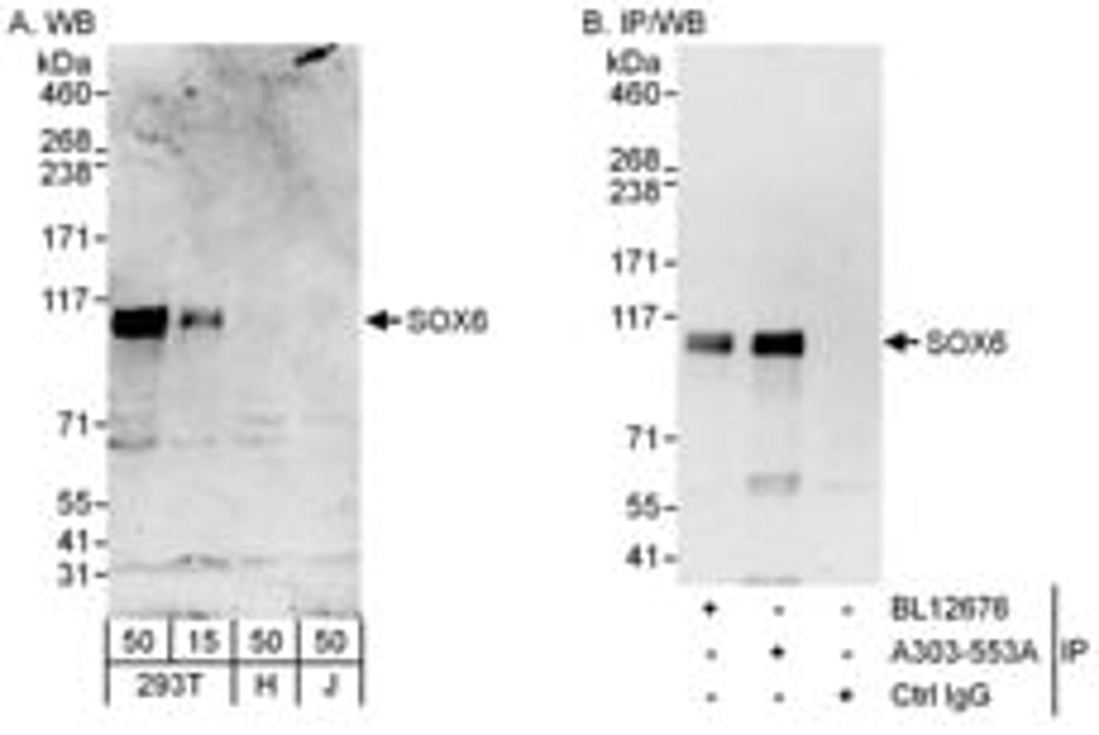 Detection of human SOX6 by western blot and immunoprecipitation.