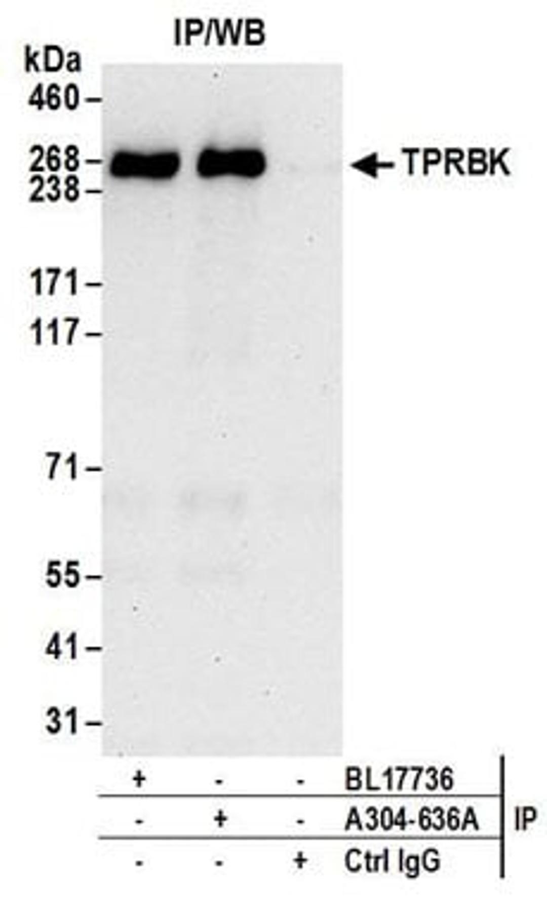 Detection of human TPRBK by western blot of immunoprecipitates.