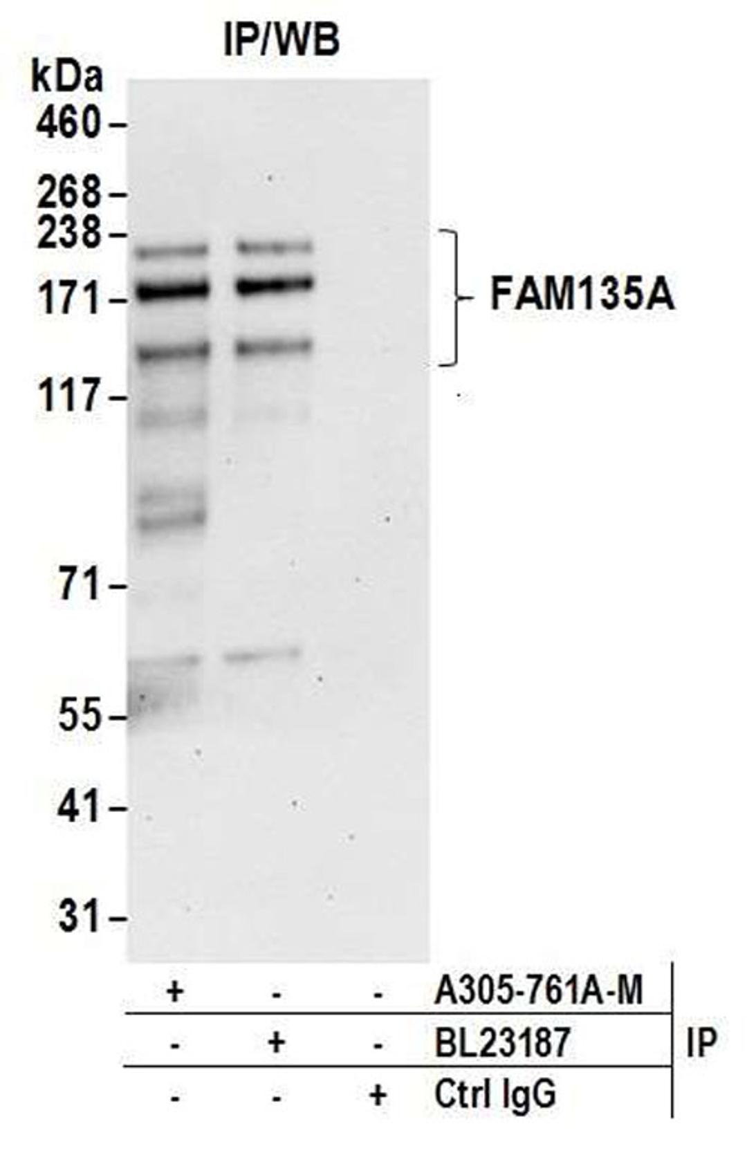 Detection of human FAM135A by WB of IP.