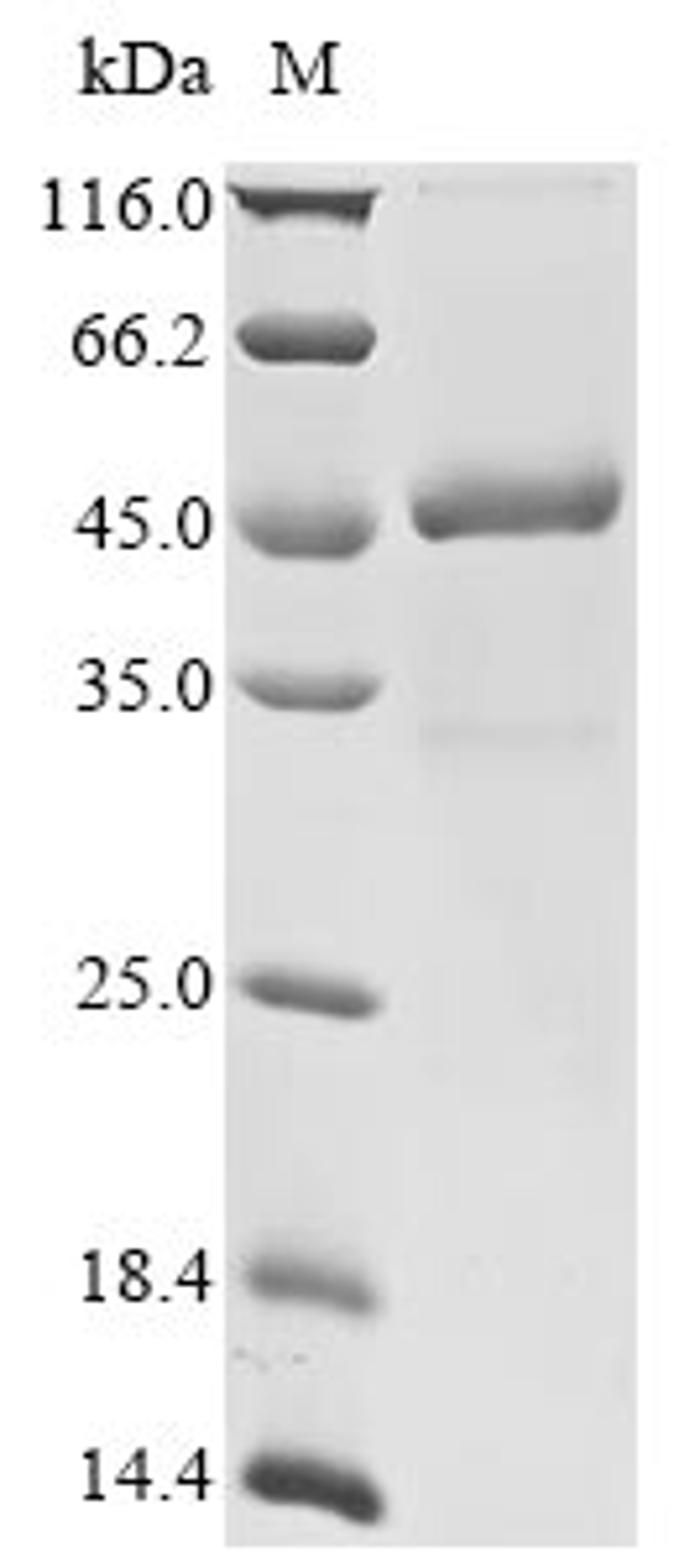 (Tris-Glycine gel) Discontinuous SDS-PAGE (reduced) with 5% enrichment gel and 15% separation gel.