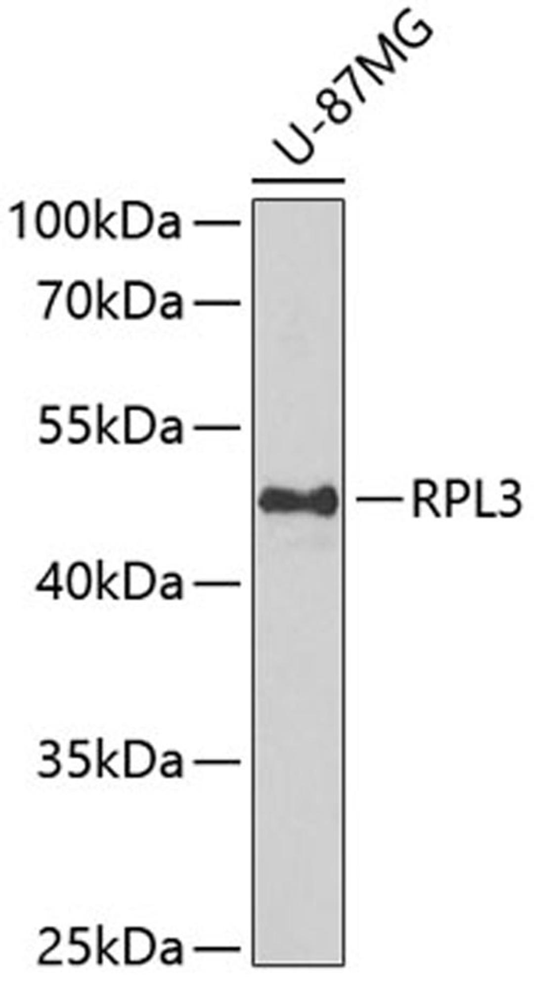 Western blot - RPL3 antibody (A6973)