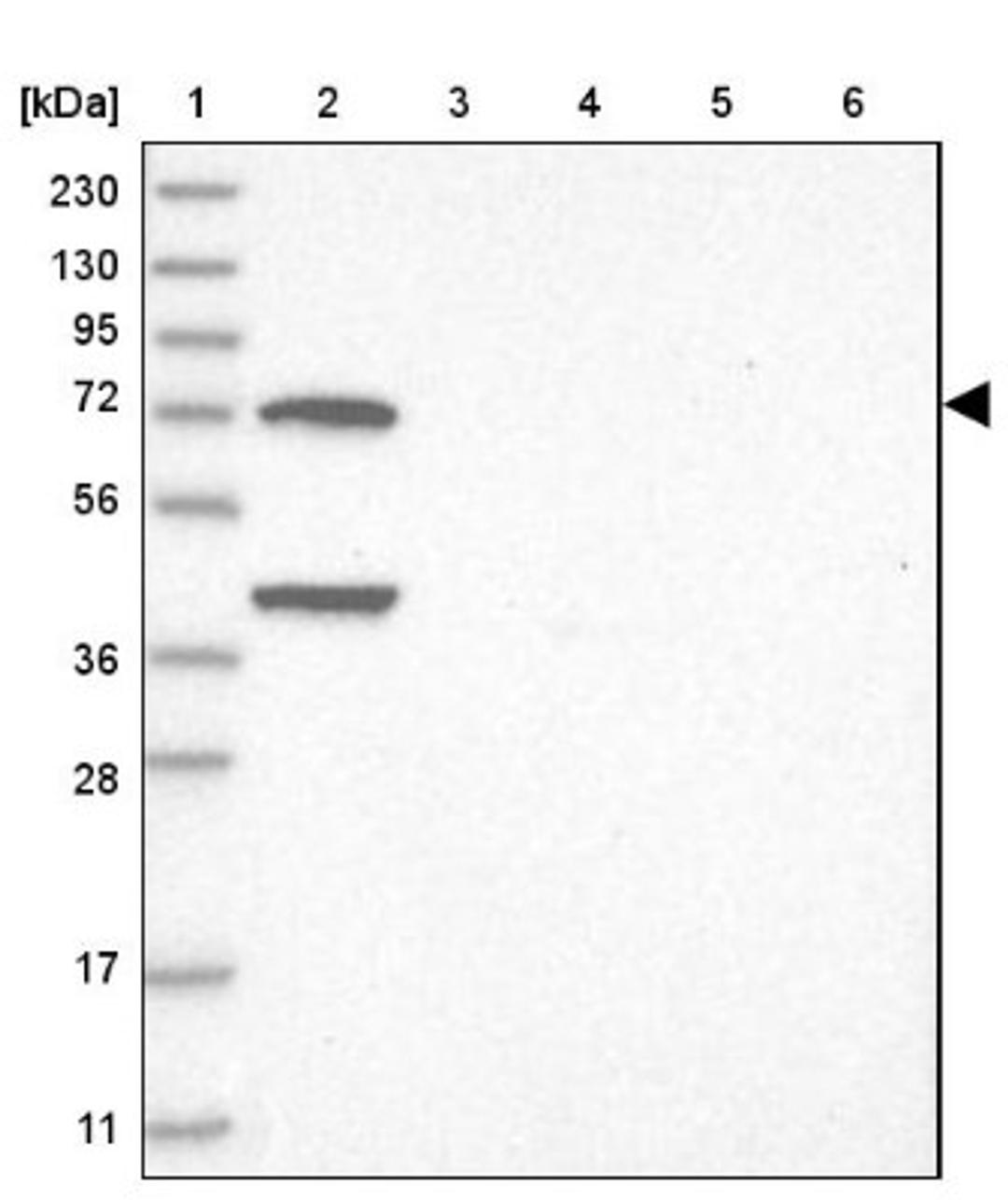 Western Blot: LMOD1 Antibody [NBP1-89396] - Lane 1: Marker [kDa] 230, 130, 95, 72, 56, 36, 28, 17, 11<br/>Lane 2: Human cell line RT-4<br/>Lane 3: Human cell line U-251MG sp<br/>Lane 4: Human plasma (IgG/HSA depleted)<br/>Lane 5: Human liver tissue<br/>Lane 6: Human tonsil tissue