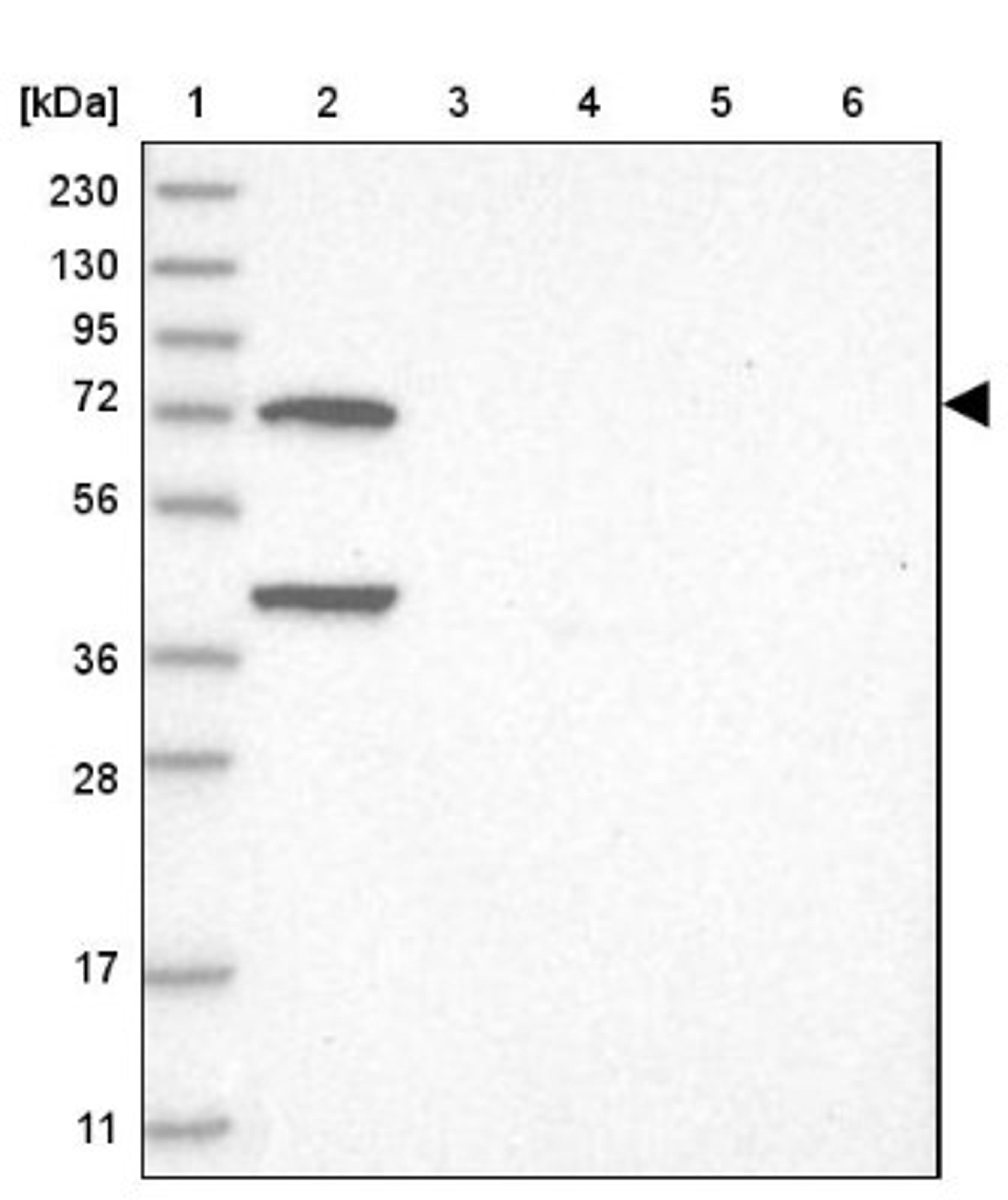 Western Blot: LMOD1 Antibody [NBP1-89396] - Lane 1: Marker [kDa] 230, 130, 95, 72, 56, 36, 28, 17, 11<br/>Lane 2: Human cell line RT-4<br/>Lane 3: Human cell line U-251MG sp<br/>Lane 4: Human plasma (IgG/HSA depleted)<br/>Lane 5: Human liver tissue<br/>Lane 6: Human tonsil tissue