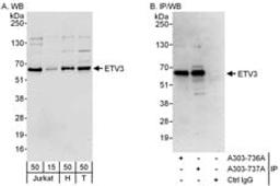 Detection of human ETV3 by western blot and immunoprecipitation.