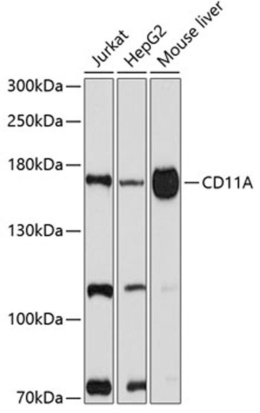 Western blot - CD11A antibody (A1644)