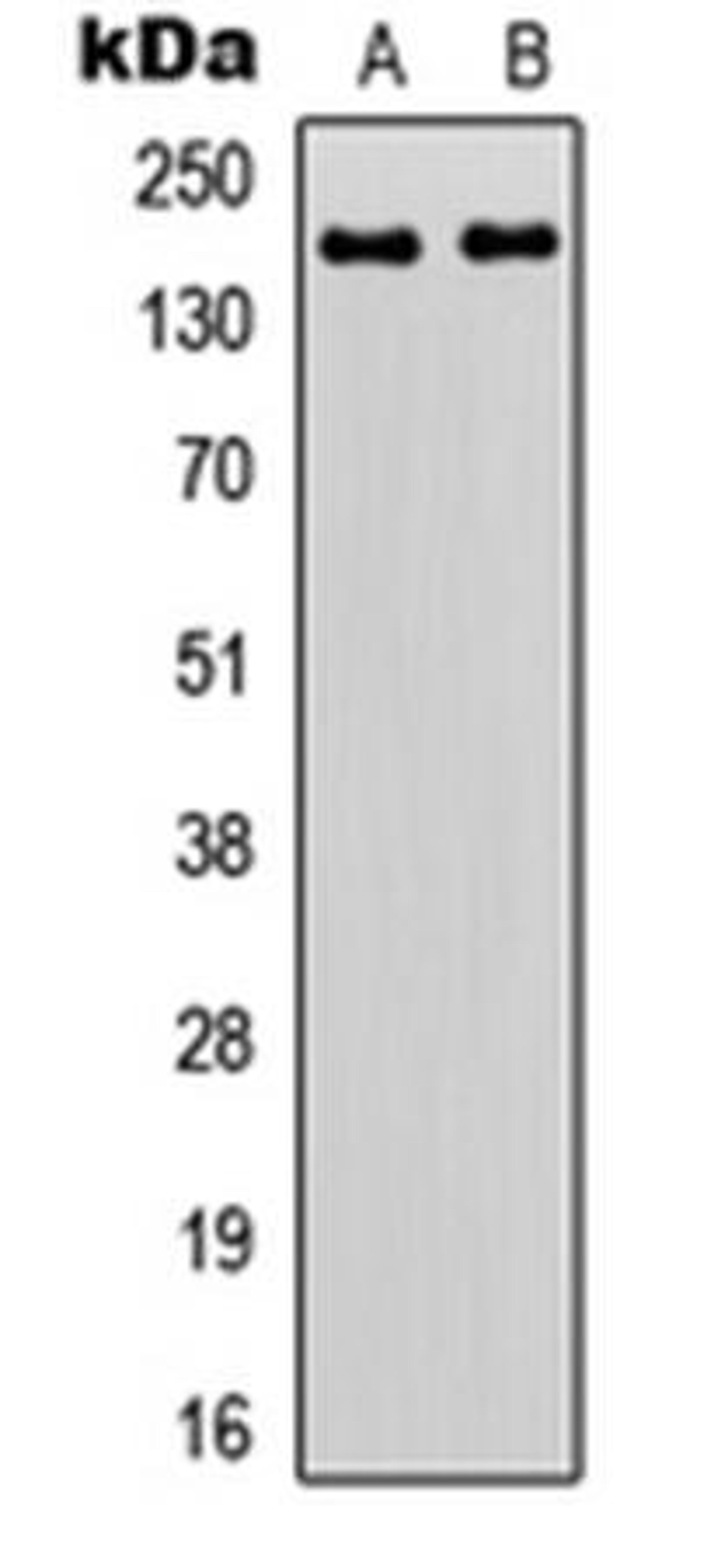 Western blot analysis of HEK293T (Lane1), HeLa (Lane2) whole cell using ZNF608 antibody