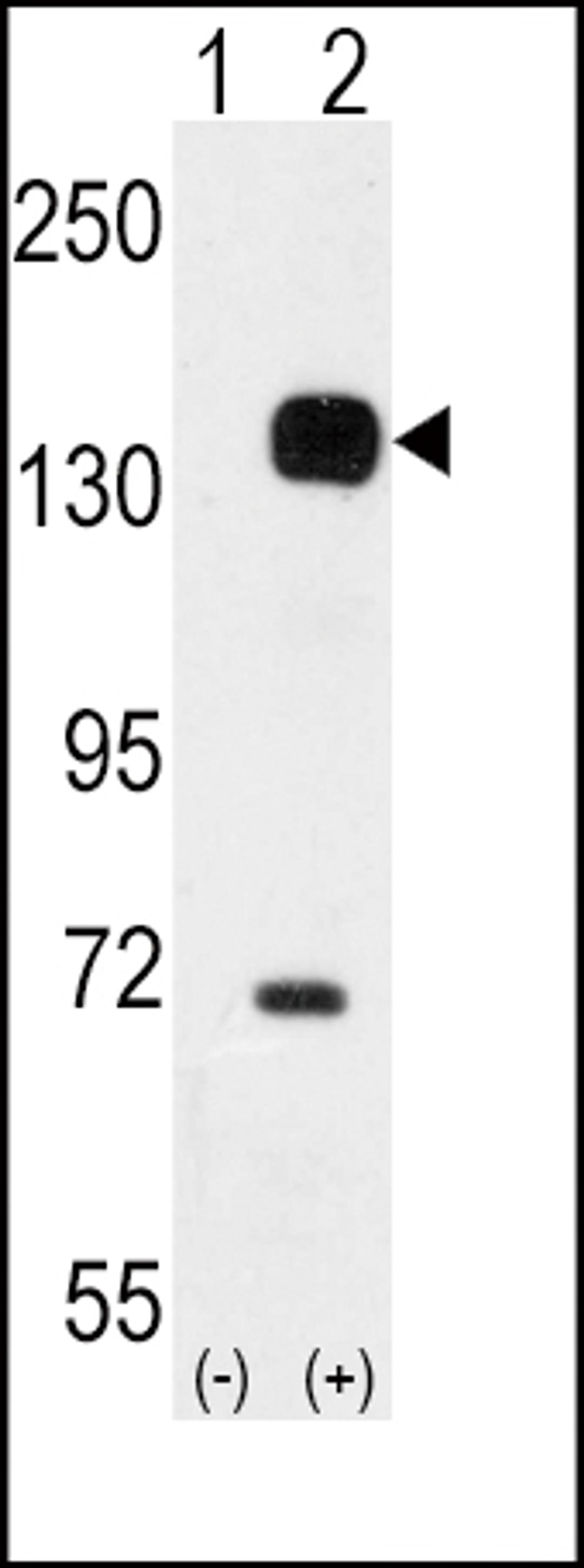 Western blot analysis of TEK using rabbit polyclonal TEK Antibody using 293 cell lysates (2 ug/lane) either nontransfected (Lane 1) or transiently transfected with the TEK gene (Lane 2).