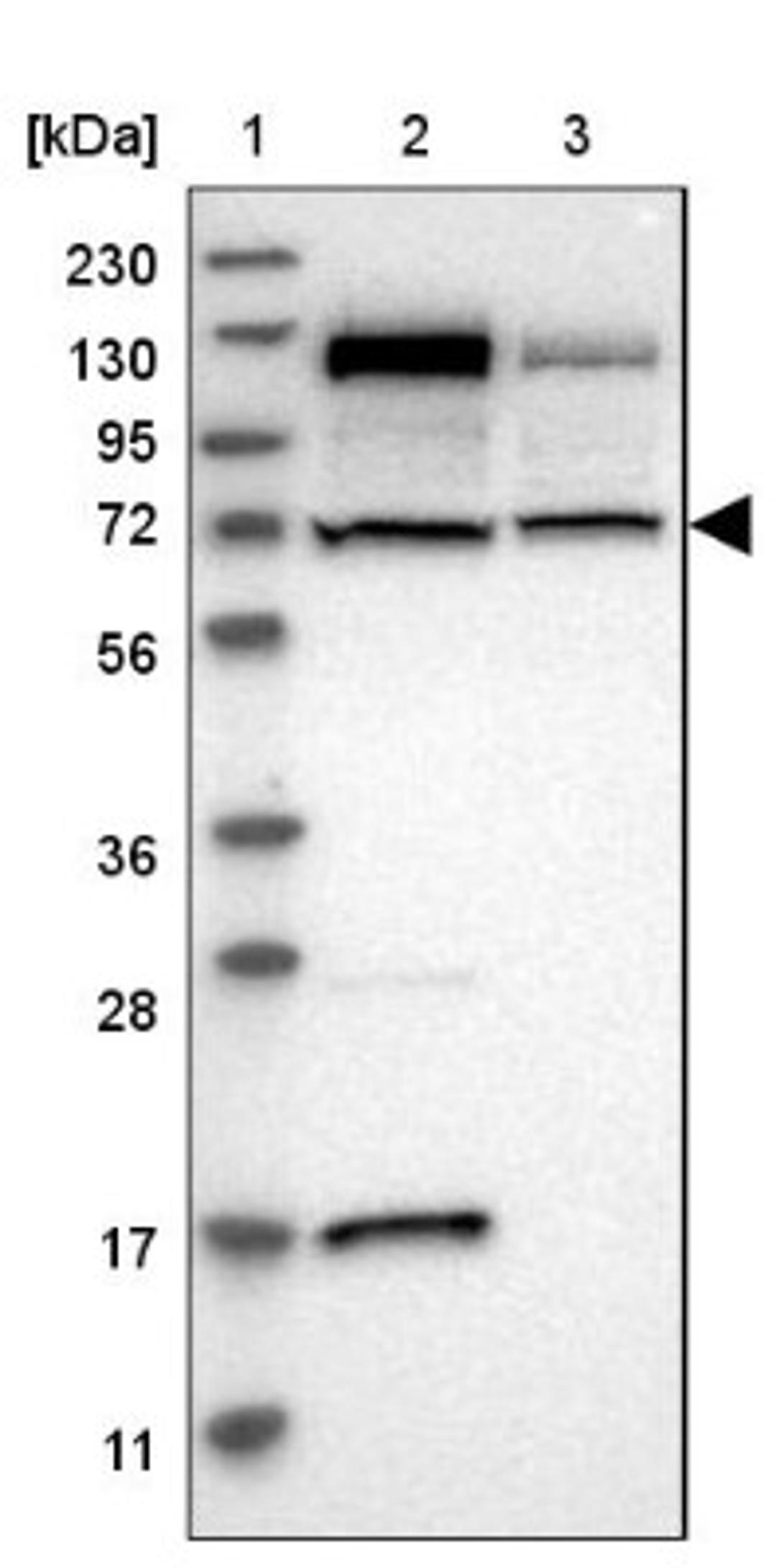 Western Blot: CASC3 Antibody [NBP1-88515] - Lane 1: Marker [kDa] 230, 130, 95, 72, 56, 36, 28, 17, 11<br/>Lane 2: Human cell line RT-4<br/>Lane 3: Human cell line U-251MG sp