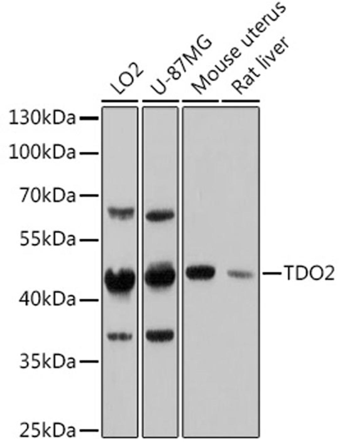 Western blot - TDO2 antibody (A13182)