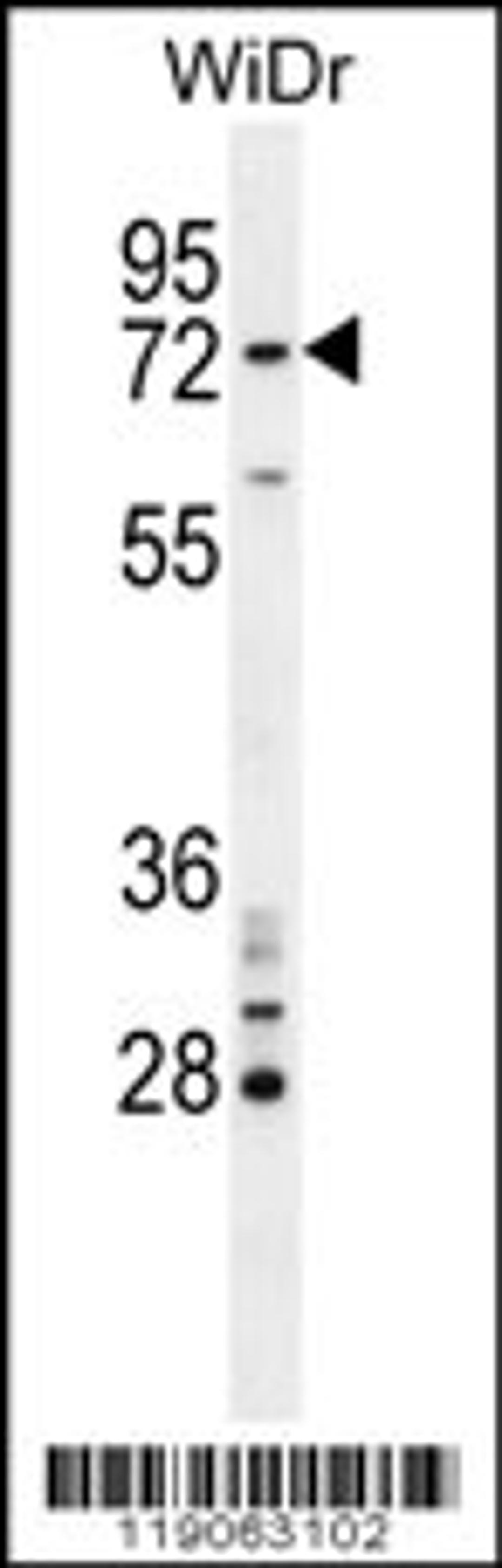 Western blot analysis in WiDr cell line lysates (35ug/lane).