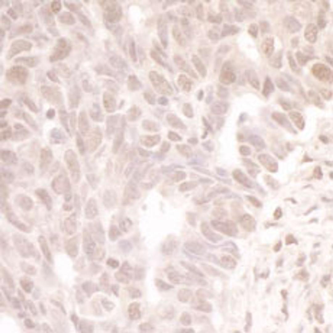 Detection of human MASTL by immunohistochemistry.