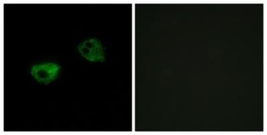 Immunocytochemistry/Immunofluorescence: Melatonin R1A/MT1/MTNR1A Antibody [NBP1-71113] - Analysis of HepG2 cells, using Melatonin  R1A/MT1/MTNR1A  Antibody. The picture on the right is treated with the synthesized peptide.