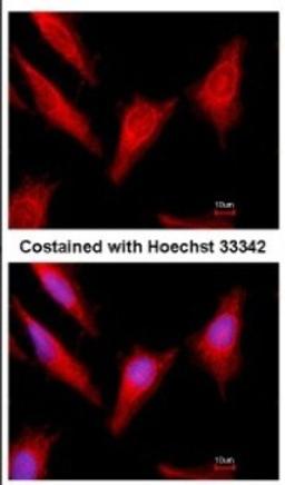 Immunocytochemistry/Immunofluorescence: Protein C Antibody [NBP2-19957] - Immunofluorescence analysis of methanol-fixed HeLa, using antibody at 1:500 dilution.