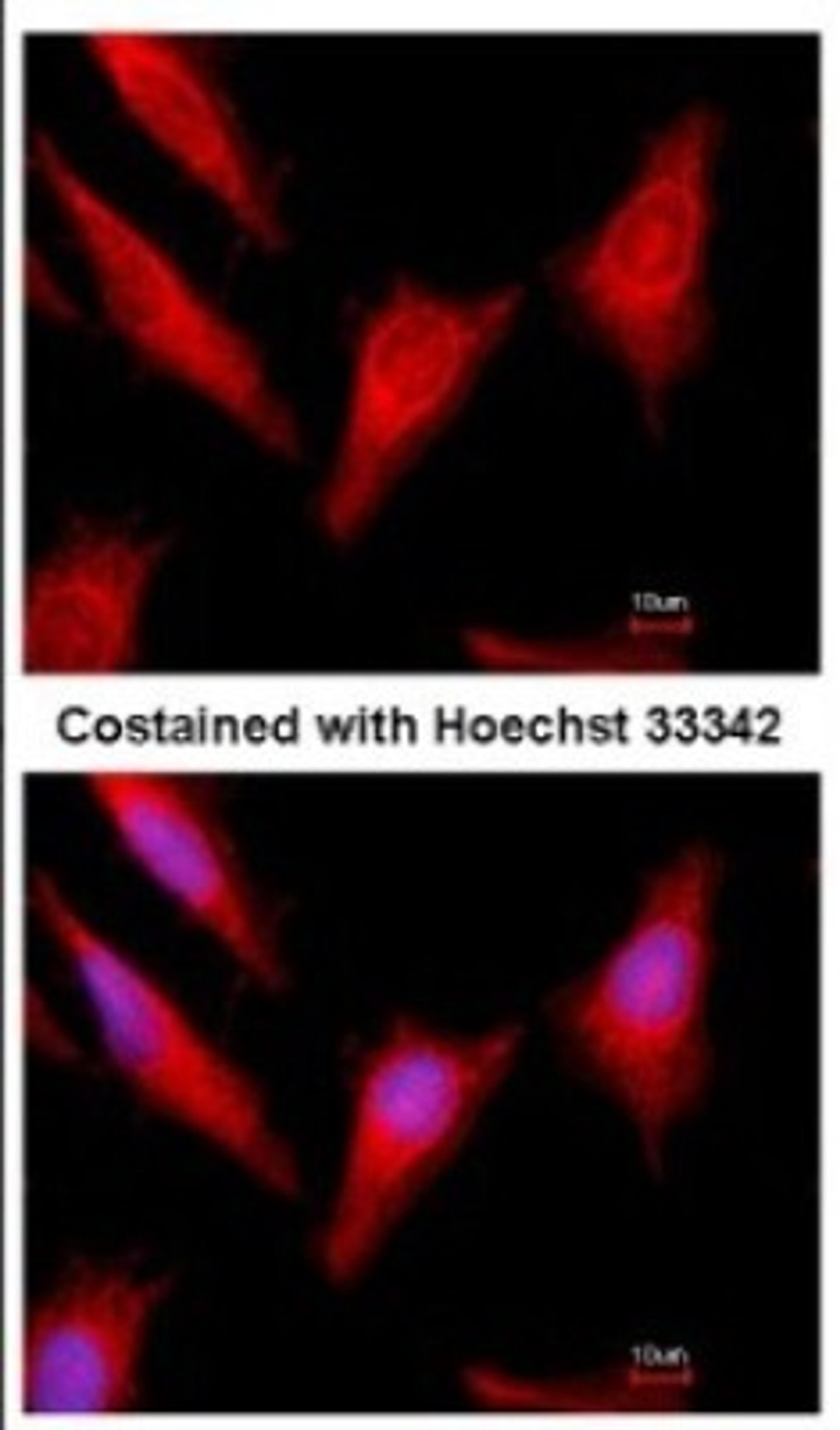 Immunocytochemistry/Immunofluorescence: Protein C Antibody [NBP2-19957] - Immunofluorescence analysis of methanol-fixed HeLa, using antibody at 1:500 dilution.