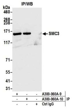 Detection of human SMC3 by western blot of immunoprecipitates.